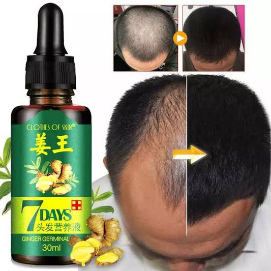 7-Day Ginger Hair Growth Serum